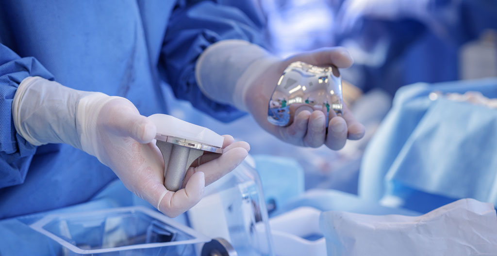 Gros plan sur un implant de prothèse de genou métallique posé sur une surface médicale blanche moderne