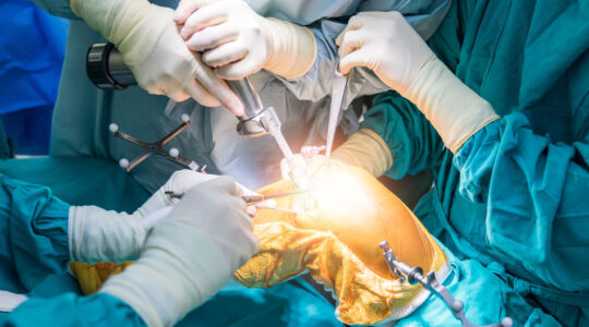 chirurgie du genou