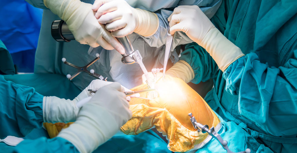chirurgie du genou